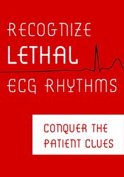 Recognize Lethal ECG Rhythms -Conquer the Patient Clues - Robin Gilbert